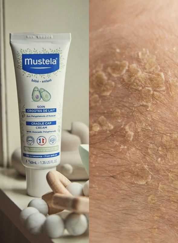 Perkujdesje per korickat e qumeshtit 40 ml